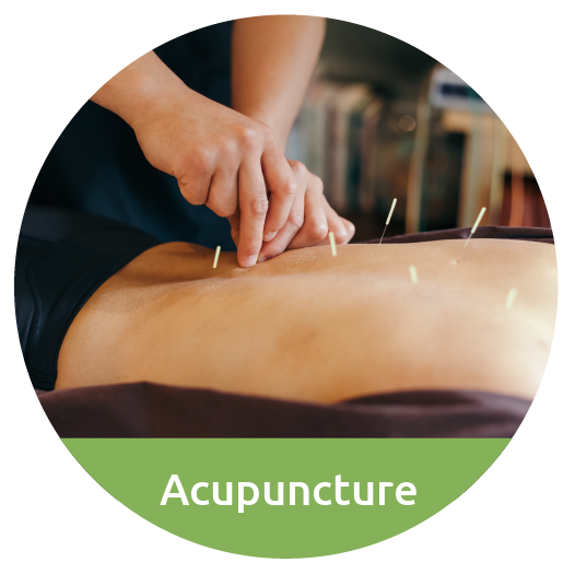 acupuncture in Takapuna